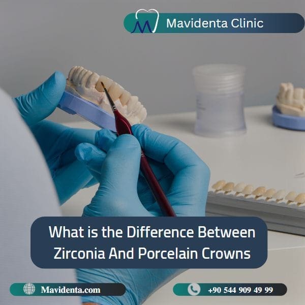 Difference Between Zirconia And Porcelain Crowns Difference Between Zirconia And Porcelain Crowns