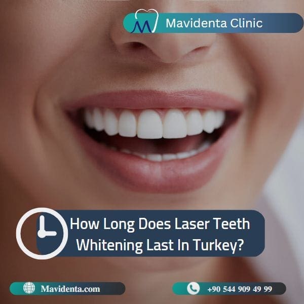 laser teeth whitening Turkey cost laser teeth whitening Turkey cost
