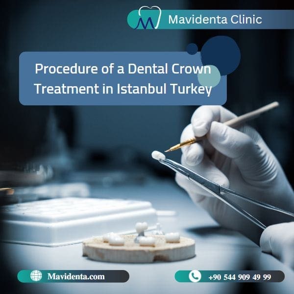 The Best Dentist In Turkey For Crowns The Best Dentist In Turkey For Crowns