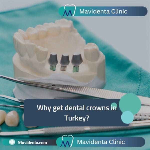 The Best Dentist In Turkey For Crowns The Best Dentist In Turkey For Crowns