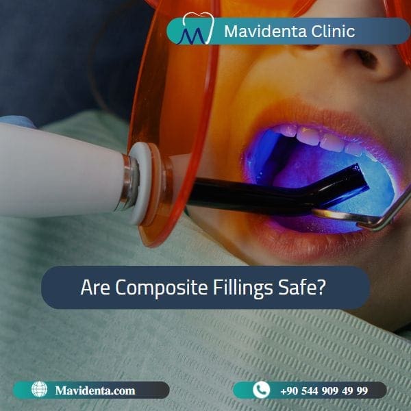 Teeth Composite Filling Cost Teeth Composite Filling Cost