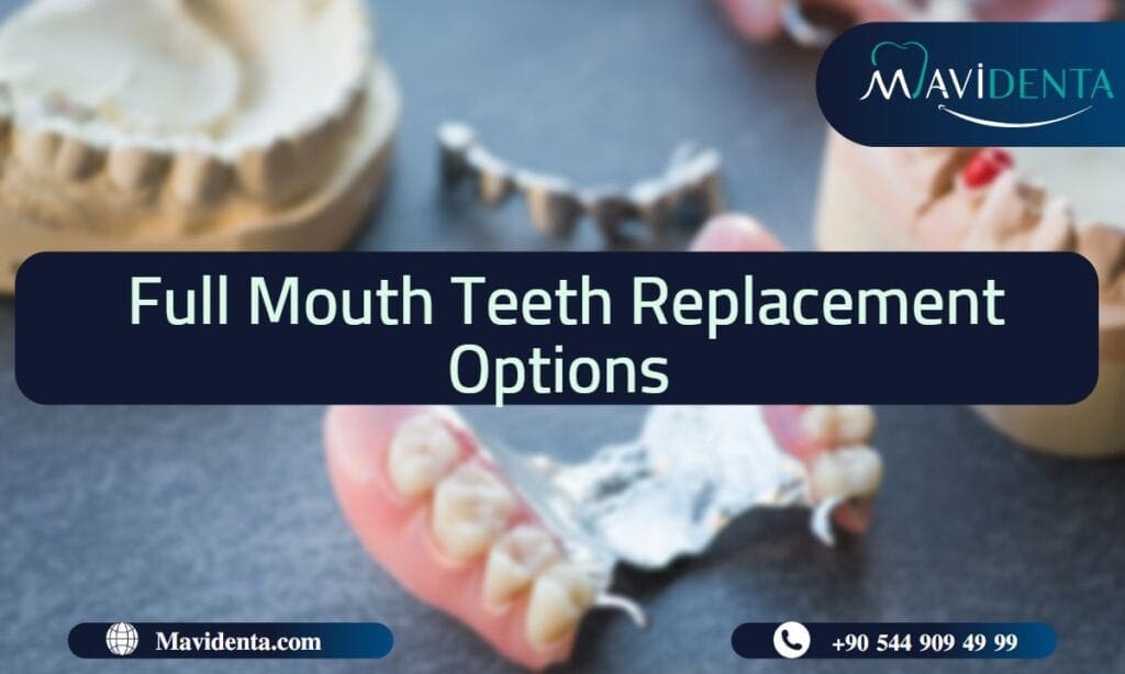 Full Mouth Teeth Replacement Options