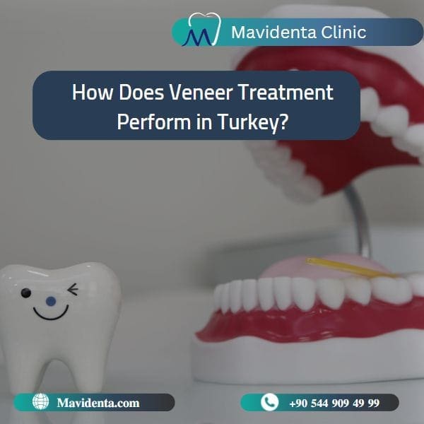 best place for veneers Turkey