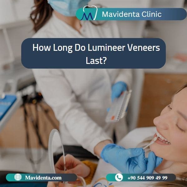 Lumineers Veneers Turkey Lumineers Veneers Turkey
