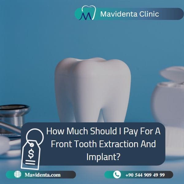 Front Tooth Extraction and Implant Front Tooth Extraction and Implant