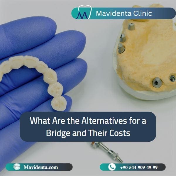 Full mouth dental bridge cost