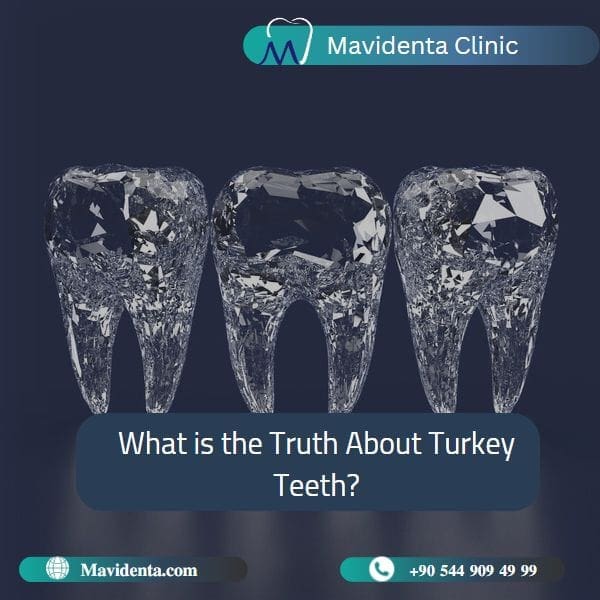 Как выбрать лучшего стоматолога в Стамбуле, Турция Best Dentists In Istanbul Turkey
