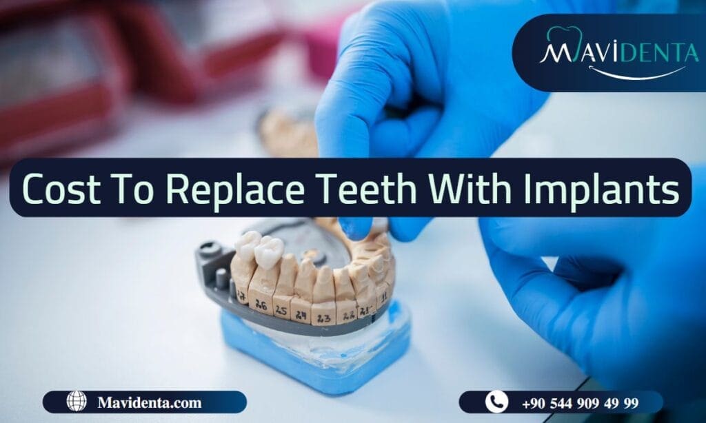  cost to replace teeth with implants