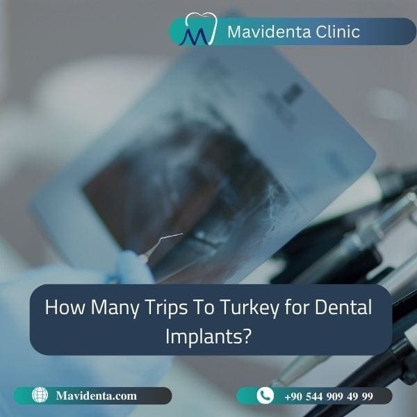 Dental holiday packages Turkey Dental holiday packages Turkey