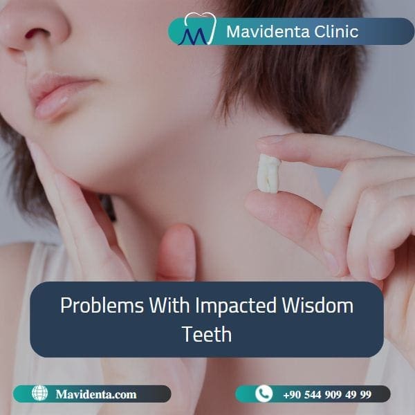 Wisdom Teeth Removal In Turkey