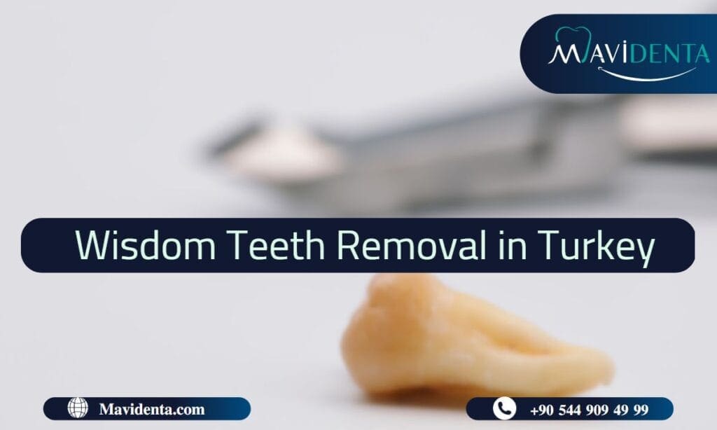 Wisdom Teeth Removal In Turkey