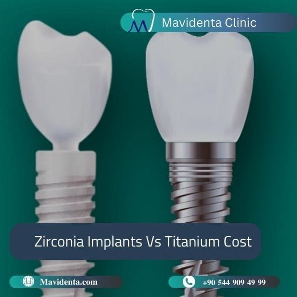 Which Is Better Zirconia Or Titanium Implants  