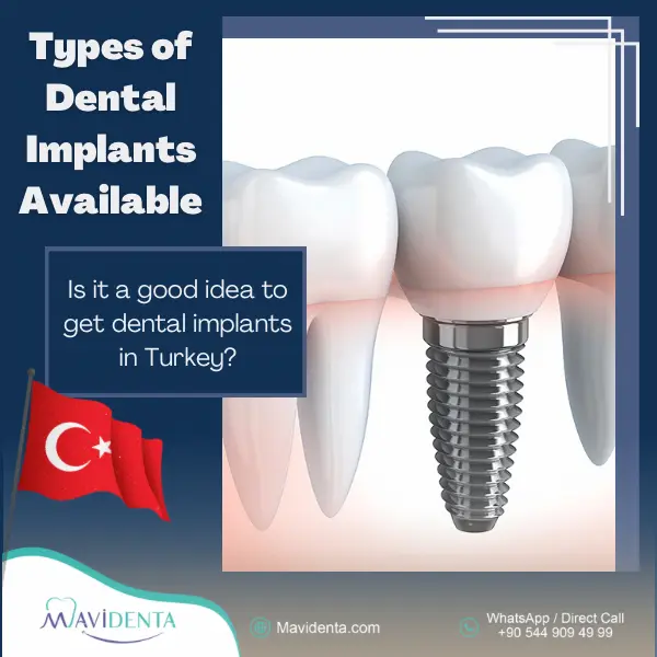 El mejor precio en implantes dentales en Turquía El mejor precio en implantes dentales en Turquía