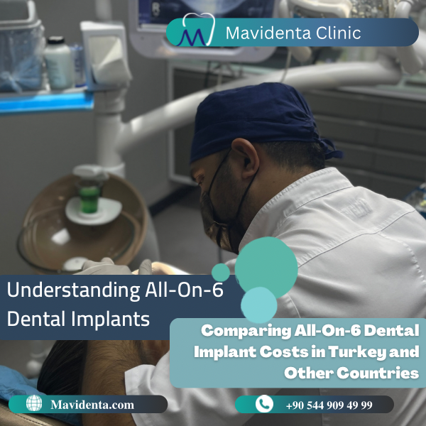 All On 6 Dental Implants Cost In Turkey