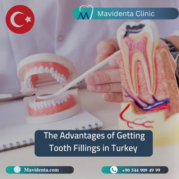 Tooth Filling Cost In Turkey Tooth Filling Cost In Turkey