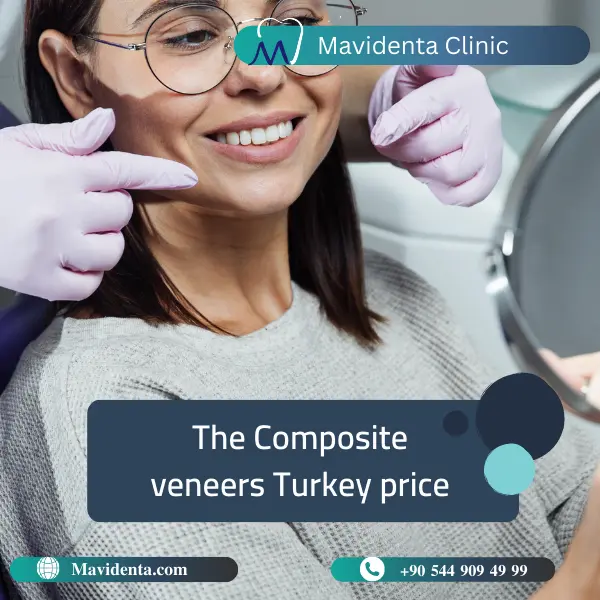 Composite Veneers Turkey Price Composite Veneers Turkey Price