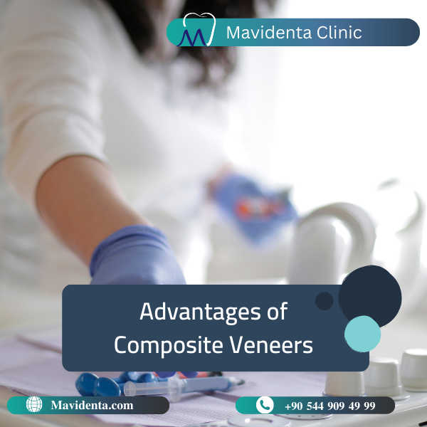 Composite Veneers Turkey Price Effective Solution for Your Perfect Smile Composite Veneers Turkey Price Effective Solution for Your Perfect Smile