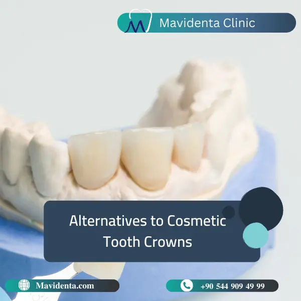 Cosmetic Tooth Crown