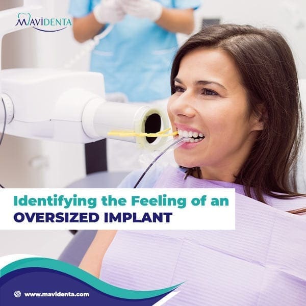 Implante dental que se siente demasiado grande Implante dental que se siente demasiado grande