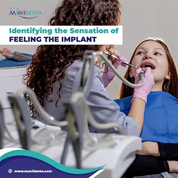 ¿Debería ser capaz de sentir mi implante dental? ¿Debería ser capaz de sentir mi implante dental?