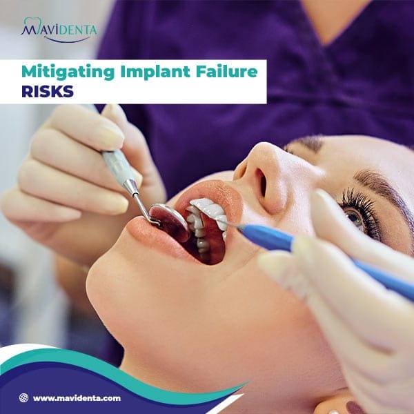 Who Is Responsible For Dental Implant Failure Who Is Responsible For Dental Implant Failure
