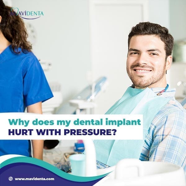 Sensación de presión en el implante dental Sensación de presión en el implante dental