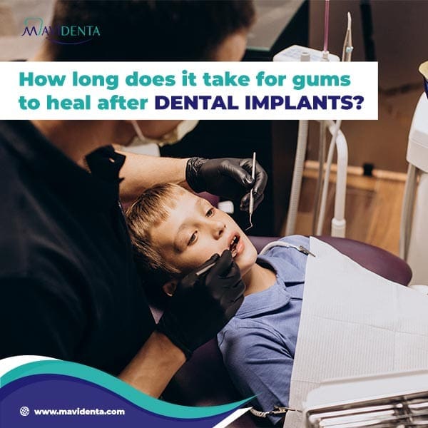 How To Heal Faster After Dental Implants How To Heal Faster After Dental Implants