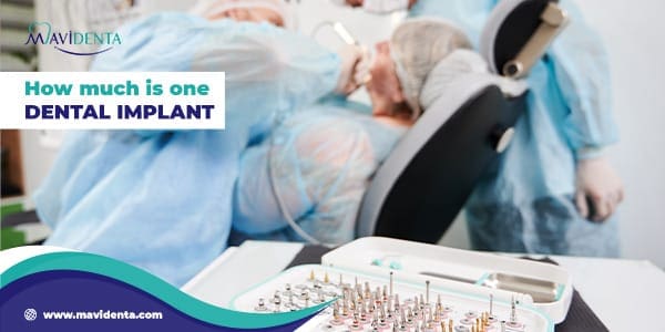 how much is one dental implant