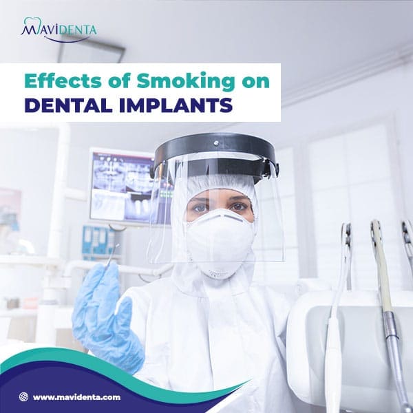 Light smoking after dental implant