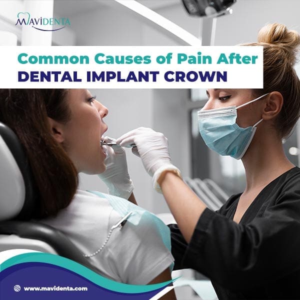 Common Causes of Pain After Dental Implant Crown