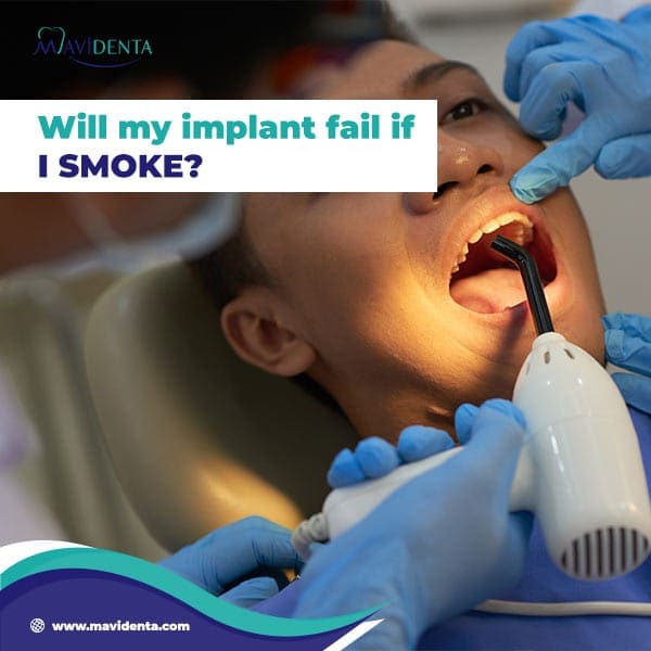 Will my implant fail if I smoke?