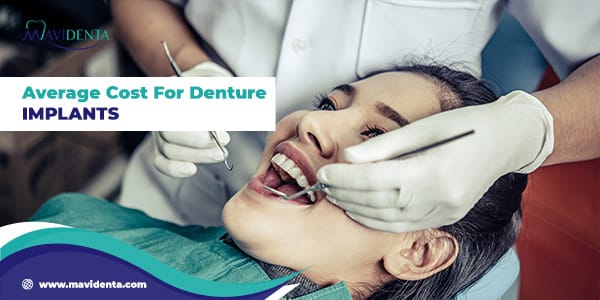 Average Cost For Denture Implants
