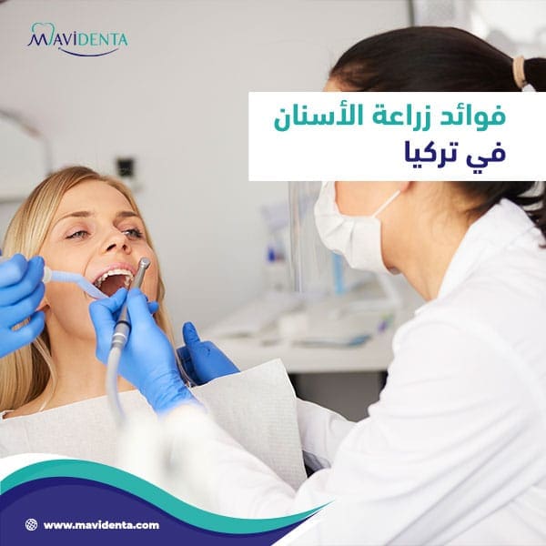 زراعة الأسنان في تركيا