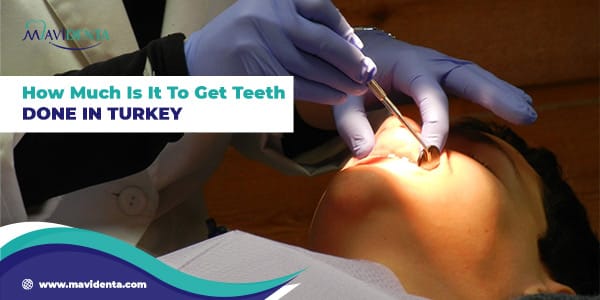 How Much Is It To Get Teeth Done In Turkey