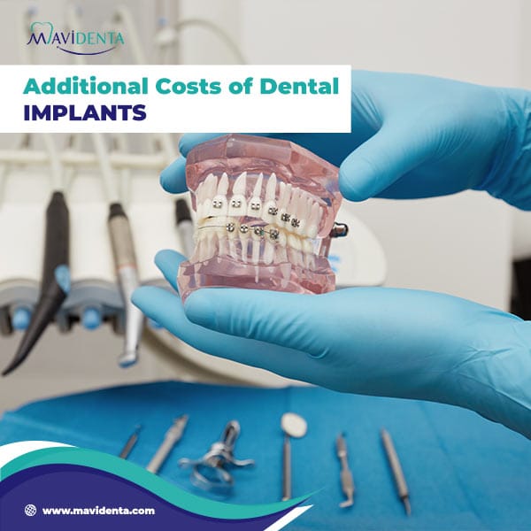 How Much Is Dental Implants Cost Guide Turkey Additional Costs of Dental Implants