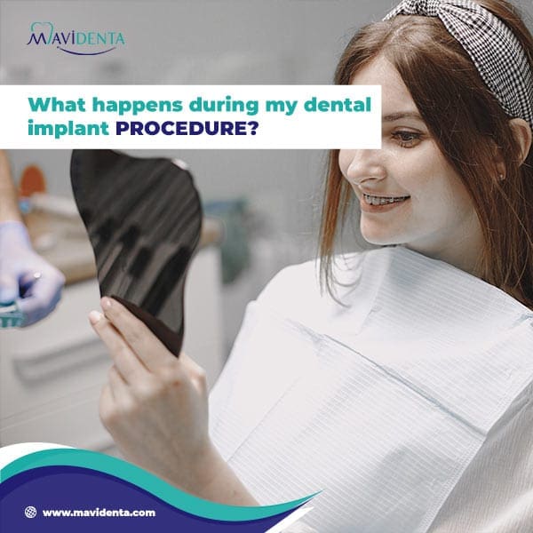 is dental implants safe?