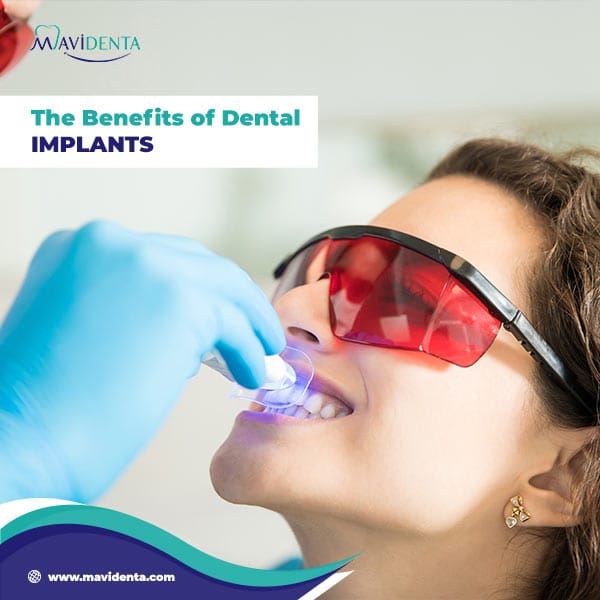 What is the Best Country for Dental Implants
