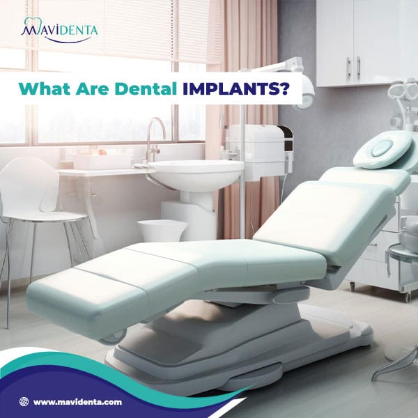 Most Affordable Dental Implants