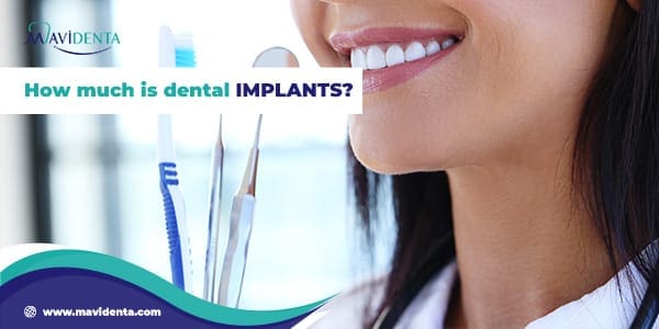 How much is dental implants?