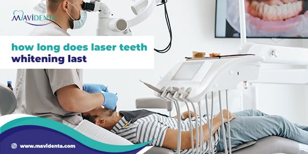 how long does laser teeth whitening last