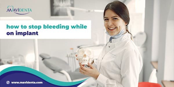 how to stop bleeding while on implant