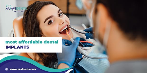 Most Affordable Dental Implants