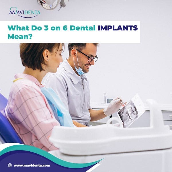 three on six dental implants