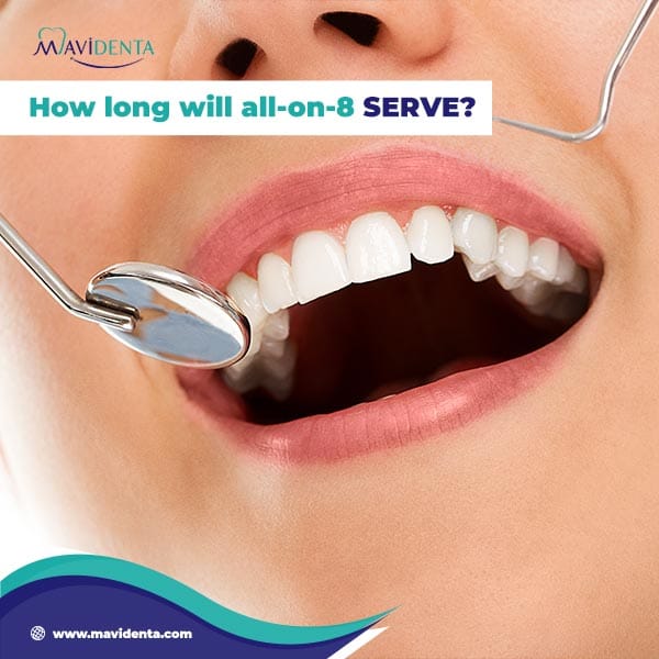 all on 8 dental implants turkey How long will all-on-8 serve