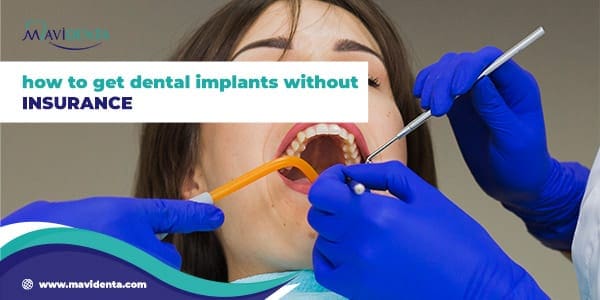 How to get dental implants without insurance