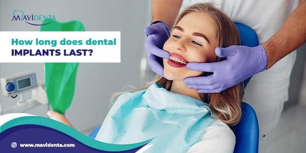 How Long Does Dental Implants Last