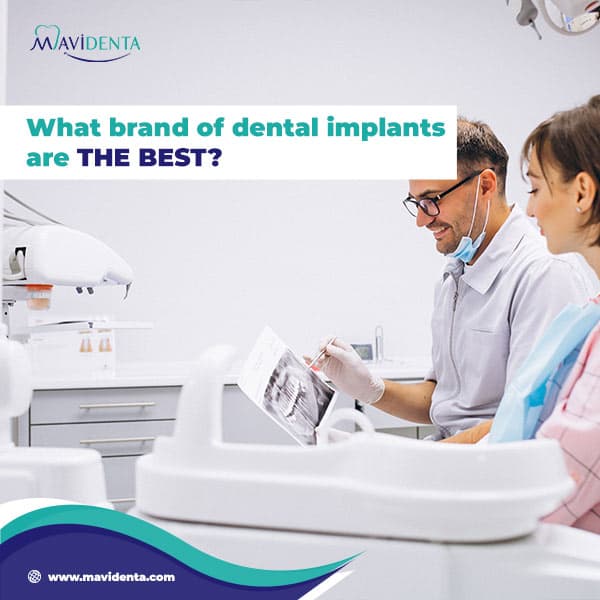 best rated dental implants