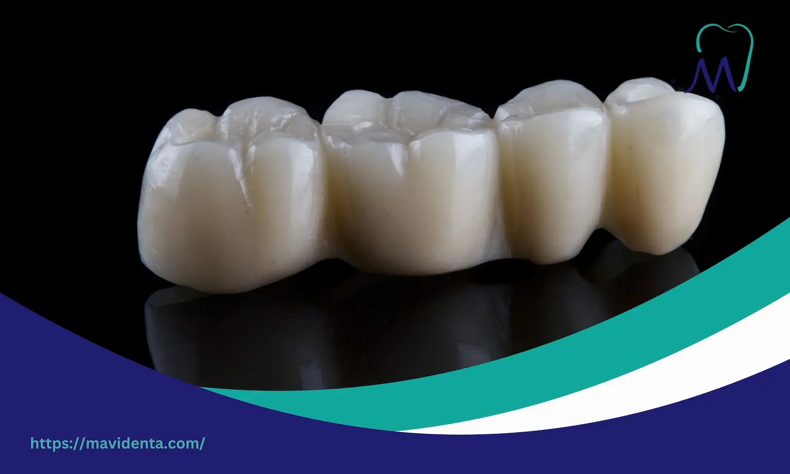Zirconium Crowns Vs Veneers Zirconium Crowns Vs Veneers