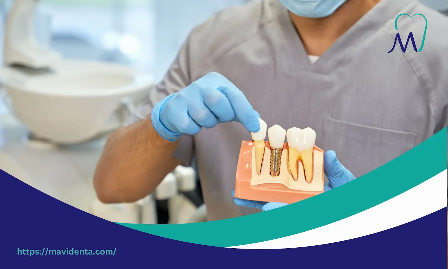 Dental Implants Cost For Whole Mouth Dental Implants Cost For Whole Mouth