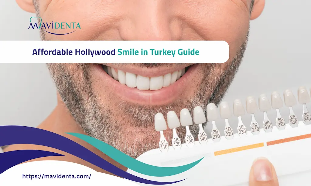 Affordable Hollywood Smile in Turkey